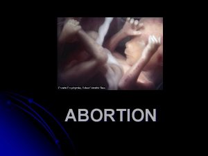 ABORTION ABORTION Abortion is an operation or other