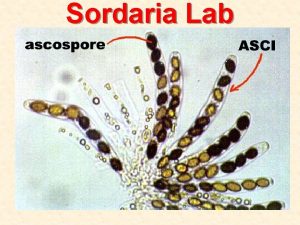 Sordaria Lab Lab 3 Mitosis Meiosis Exercise 3