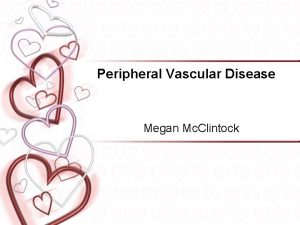 Peripheral Vascular Disease Megan Mc Clintock Peripheral Artery