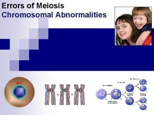 Errors of Meiosis Chromosomal Abnormalities Chromosomal abnormalities n