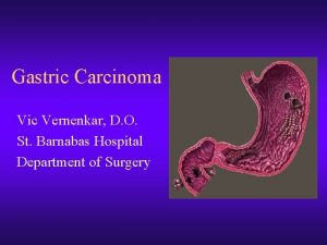 Gastric Carcinoma Vic Vernenkar D O St Barnabas