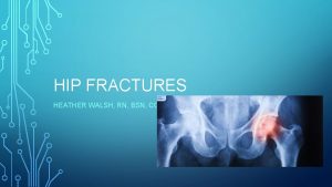 HIP FRACTURES HEATHER WALSH RN BSN CCRN FRACTURE