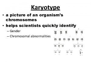 Karyotype a picture of an organisms chromosomes helps