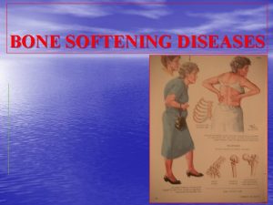 BONE SOFTENING DISEASES BONE TISSUE CELLS BONE FORMING