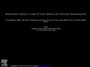 Multimodality Imaging in a Case of Chronic Massive