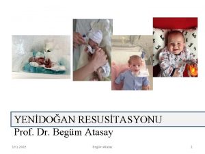 YENDOAN RESUSTASYONU Prof Dr Begm Atasay 19 1