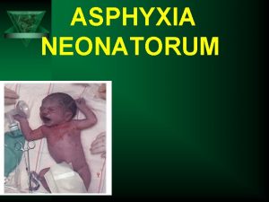 ASPHYXIA NEONATORUM DEFINITION Asphyxia neonatorum means nonestablishment of