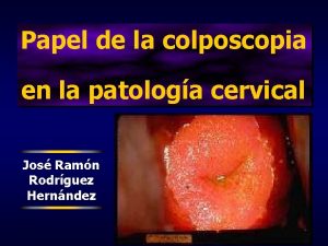 Papel de la colposcopia en la patologa cervical