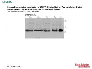 Immunohistochemical Localization of DARPP32 in the Brain of