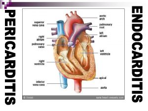 PERICARDITIS Pericarditis is the inflammation of the membranous