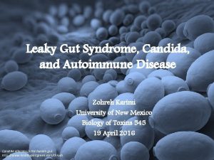 Leaky Gut Syndrome Candida and Autoimmune Disease Zohreh