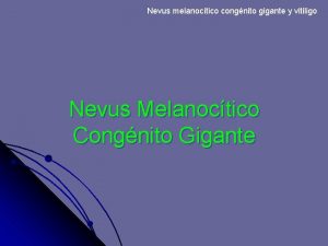 Nevus melanoctico congnito gigante y vitiligo Nevus Melanoctico