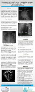 From abnormal chest Xray to a rare cardiac