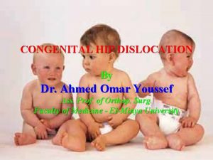 CONGENITAL HIP DISLOCATION By Dr Ahmed Omar Youssef