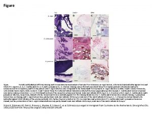 Figure Periodic acidndash Schiff PAS staining and immunohistochemical