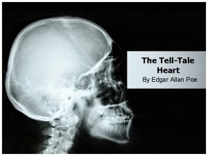 The TellTale Heart By Edgar Allan Poe The