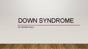 DOWN SYNDROME BY NATHAN CULLO About Down Syndrome