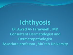 Ichthyosis Dr Awad AlTarawneh MD Consultant Dermatologist and