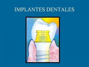 IMPLANTES DENTALES HISTORIA MAGGIOLO HARRIS GULFORD BERNIER BRANEMARK