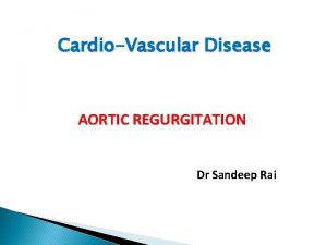 CardioVascular Disease AORTIC REGURGITATION Dr Sandeep Rai Aortic