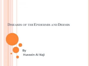 DISEASES OF THE EPIDERMIS AND DERMIS By Hussein