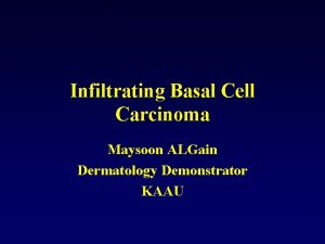 Infiltrating Basal Cell Carcinoma Maysoon ALGain Dermatology Demonstrator