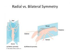 Radial vs Bilateral Symmetry Cephalization Bilateral Symmetry usually