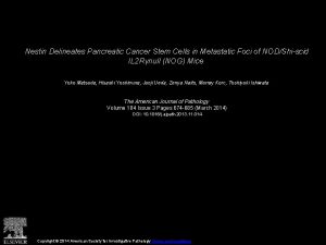 Nestin Delineates Pancreatic Cancer Stem Cells in Metastatic