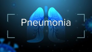 Pneumonia What is pneumonia Its It the acute