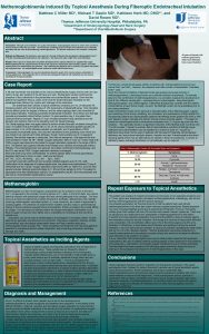 Methemoglobinemia Induced By Topical Anesthesia During Fiberoptic Endotracheal