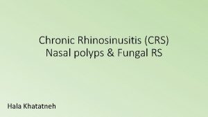 Chronic Rhinosinusitis CRS Nasal polyps Fungal RS Hala