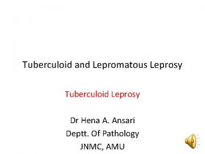 Tuberculoid and Lepromatous Leprosy Tuberculoid Leprosy Dr Hena