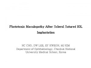 Phototoxic Maculopathy After Scleral Sutured IOL Implantation NC