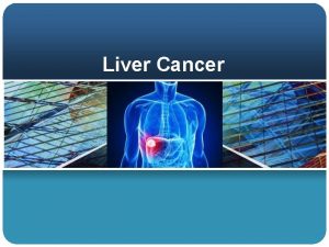 Liver Cancer Intruduction Liver Cancer Hepatocellular carcinomais a