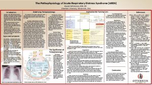 The Pathophysiology of Acute Respiratory Distress Syndrome ARDS