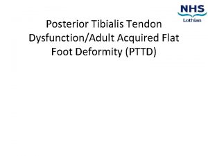 Posterior Tibialis Tendon DysfunctionAdult Acquired Flat Foot Deformity