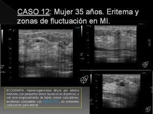 CASO 12 Mujer 35 aos Eritema y zonas