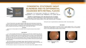 CONGENITAL STATIONARY NIGHT BLINDNESS AND ITS DIFFERENTIAL DIAGNOSIS