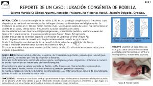 5221 REPORTE DE UN CASO LUXACIN CONGNITA DE