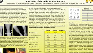 Approaches of the Ankle for Pilon Fractures Tyler