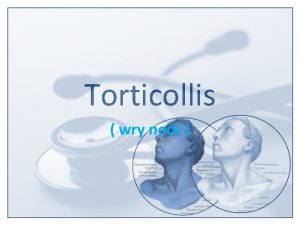 Torticollis wry neck Torticollis also known as wry