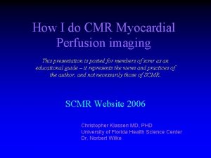 How I do CMR Myocardial Perfusion imaging This