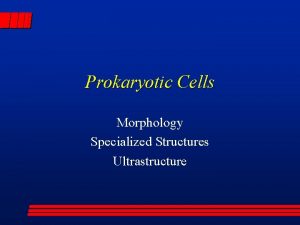 Prokaryotic Cells Morphology Specialized Structures Ultrastructure Prokaryotic Cell