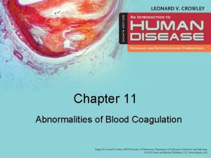 Chapter 11 Abnormalities of Blood Coagulation Learning Objectives