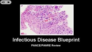 Infectious Disease Blueprint PANCEPANRE Review Fungal Disease Candidiasis