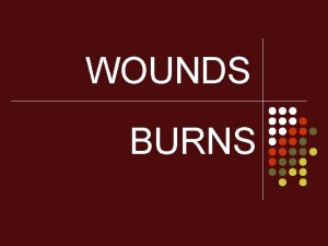 WOUNDS BURNS What is a WOUND An Injury
