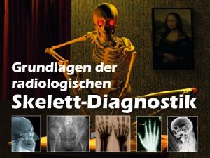 Grundlagen der radiologischen SkelettDiagnostik 2008 09 Was ist