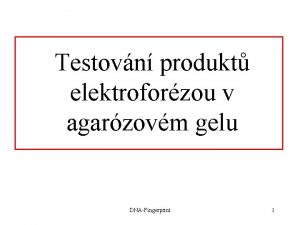 Testovn produkt elektroforzou v agarzovm gelu DNAFingerprint 1