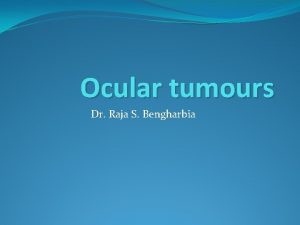 Ocular tumours Dr Raja S Bengharbia The conjunctiva