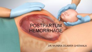 POSTPARTUM HEMORRHAGE DR MUNIRA DILAWER GHEEWALA DEFINITION OF